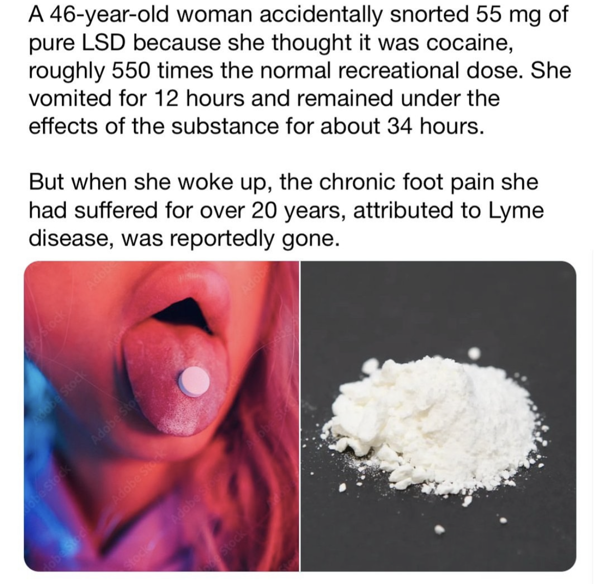 When you accidentally take 550x the dose of LSD thinking it's cocaine but it cures your 20-year foot pain