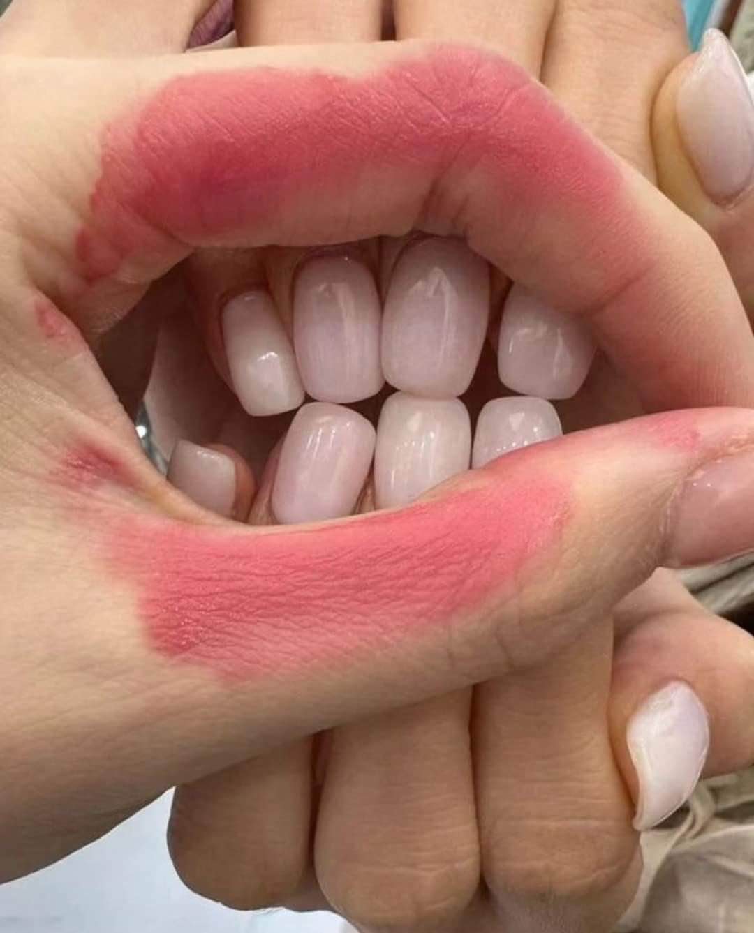When you try to act cute but your hand looks like a mouth with veneers