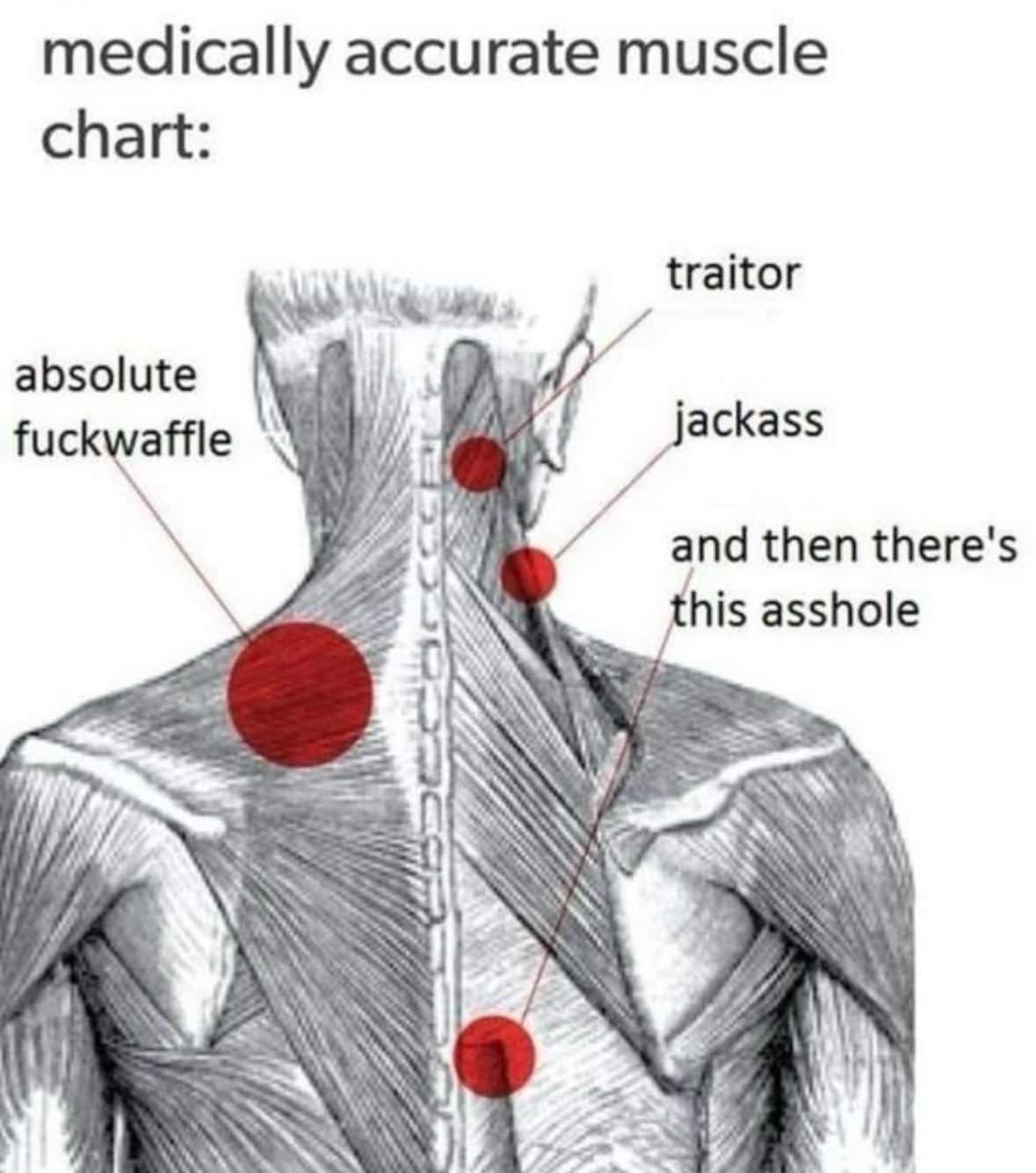When your back pain has a personality disorder