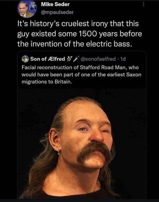 This guy's facial reconstruction is so ahead of its time, it looks like he's about to drop a 70s rock album