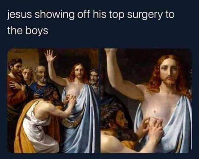 Jesus showing off his top surgery to the boys